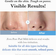 medicube Zero Pore Mild Pad 70 pads
