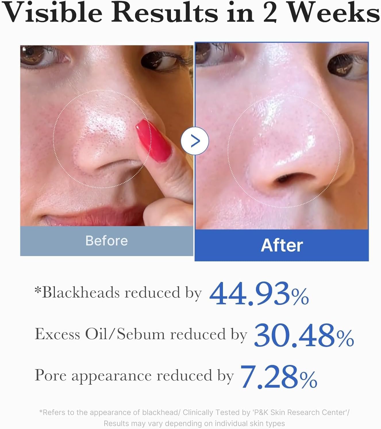 Medicube Zero Pore Pads 2.0 (70 Pads)