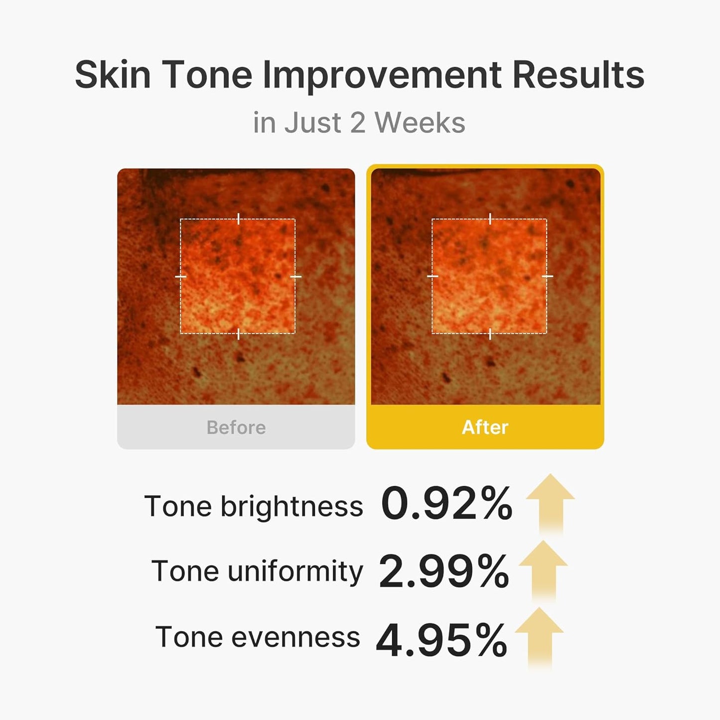 medicube Capsule Cream with Kojic Acid & Turmeric for Uneven Skin Tone | Tone Renewal & Radiance Care for troubled skin | Turmeric, Kojic, Vitamin C | Korean Skincare, 1.86 oz 53g